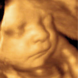 ultrasound photography by Storks & Co. 254-8100
