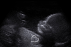 ultrasound photography by Storks & Co. 254-8100