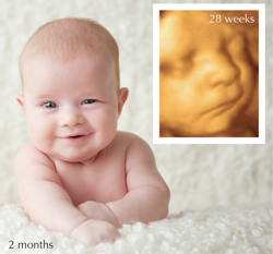 Ultrasound Photography by Storks & Co. 254-8100